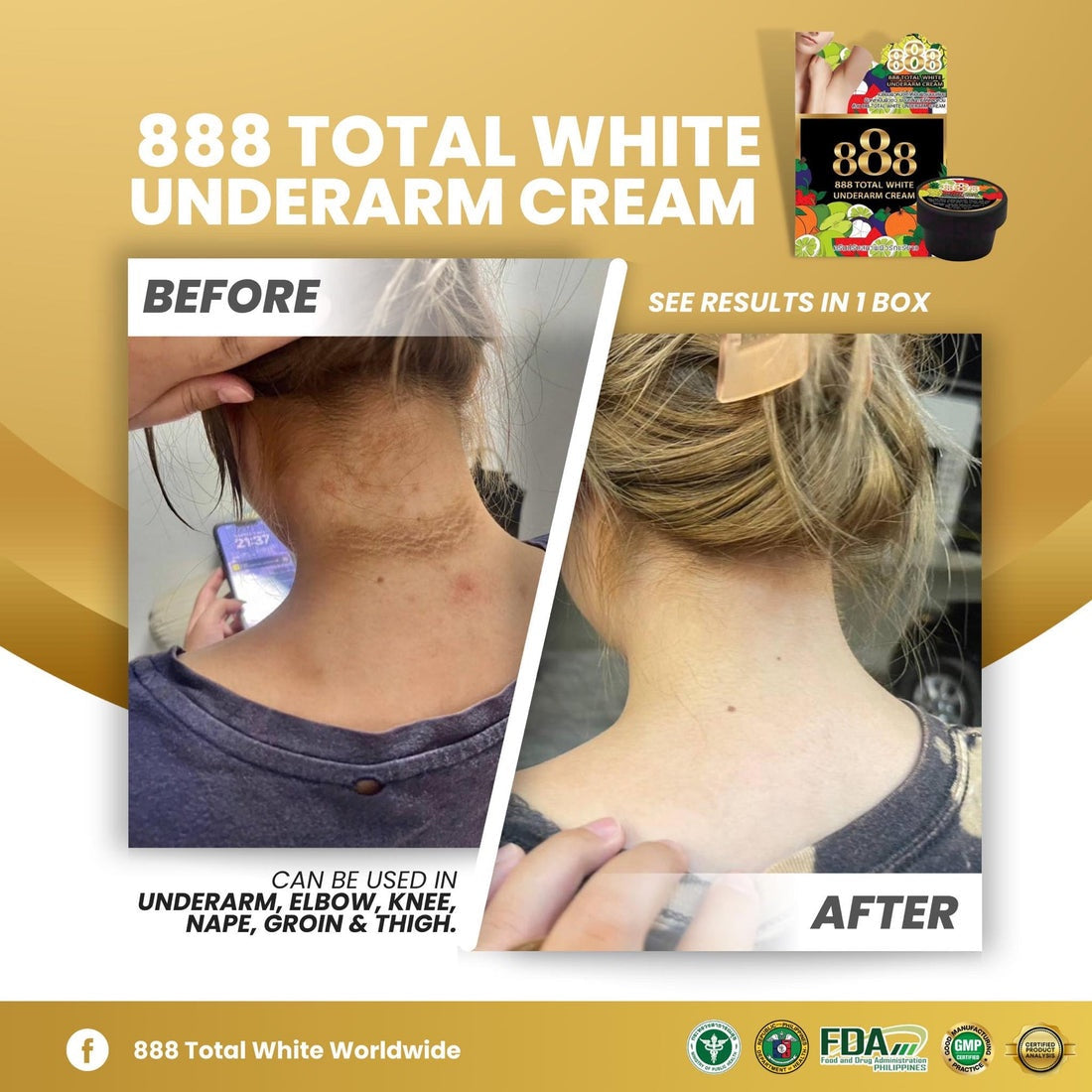 888 Total White Underarm &amp; Dark Area Lightening Cream